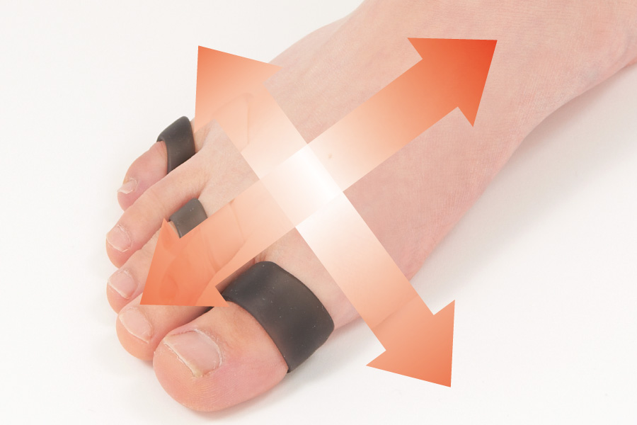 のびてしまったアーチ状の筋肉や関節を強化